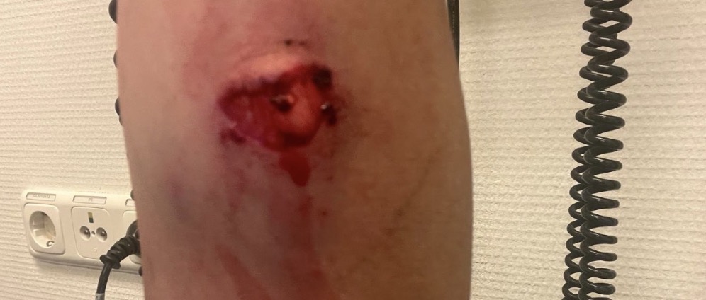 Geld inzamelen | 0 | Doneeractie