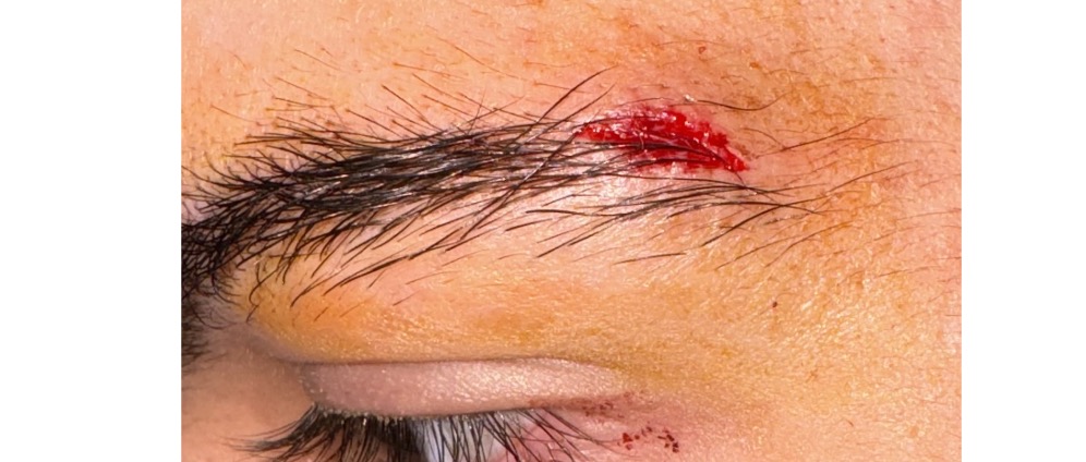 Geld inzamelen | Help me weg uit deze mishandelende thuissituatie aub | Doneeractie