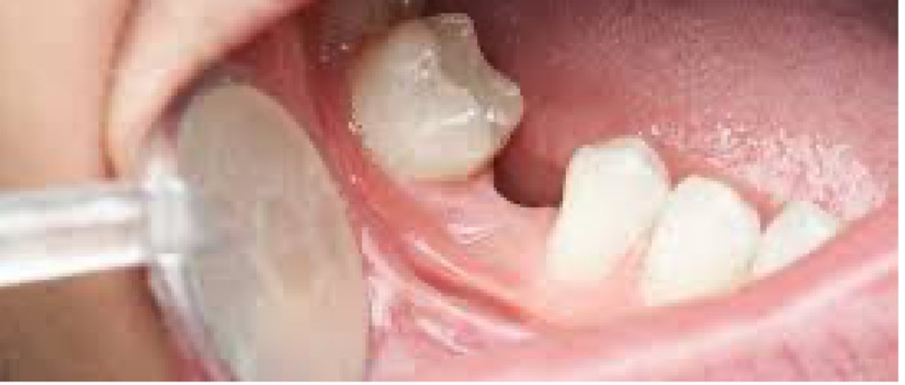 Geld inzamelen | Hulp voor tandzorg | Doneeractie