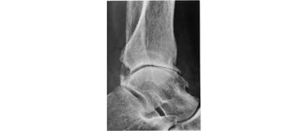 Geld inzamelen | rekening operatie | Doneeractie