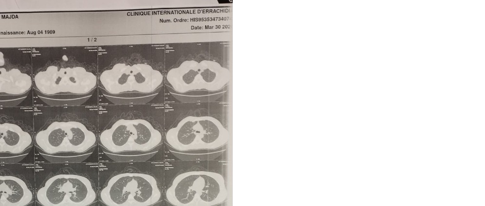 Geld inzamelen | Jonge moeder met Kanker | Doneeractie