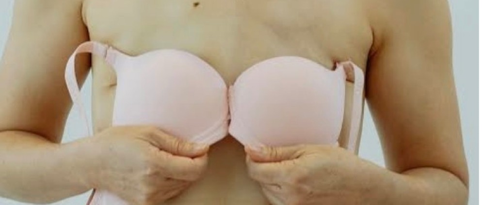 Geld inzamelen | Tepel prothese | Doneeractie