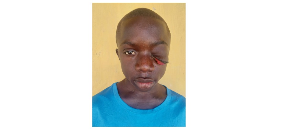 Geld inzamelen | Mohammed Oogoperatie | Doneeractie