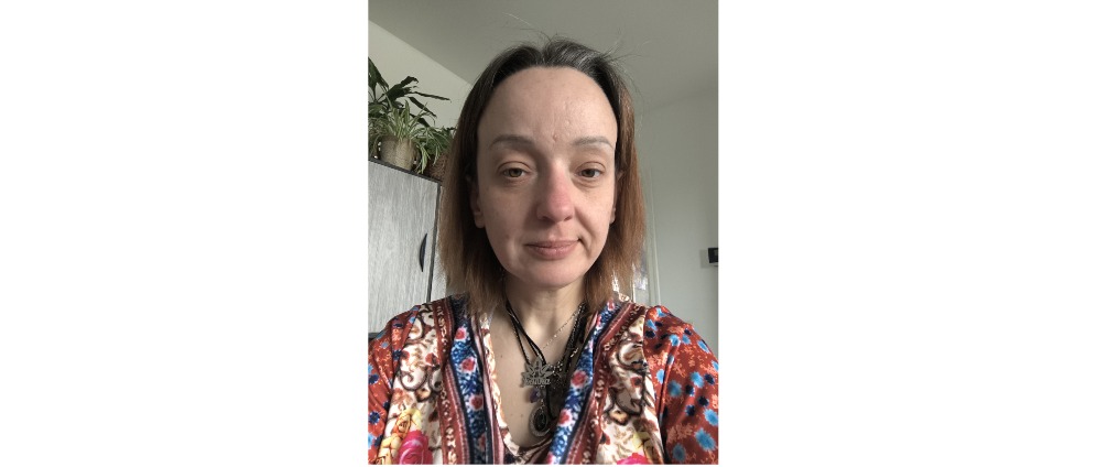 Geld inzamelen | Dringende gelp | Doneeractie