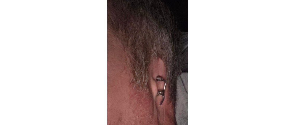 Geld inzamelen | Help mij weer horen | Doneeractie