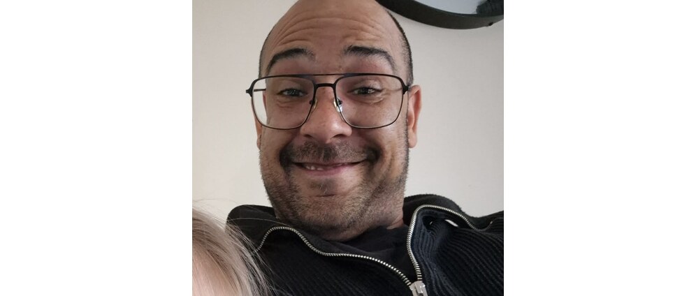 Geld inzamelen | Help onze broer zijn haartransplantatie door | Doneeractie
