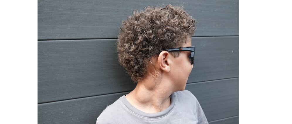 Geld inzamelen | Help Ugo minder pijn te hebben | Doneeractie