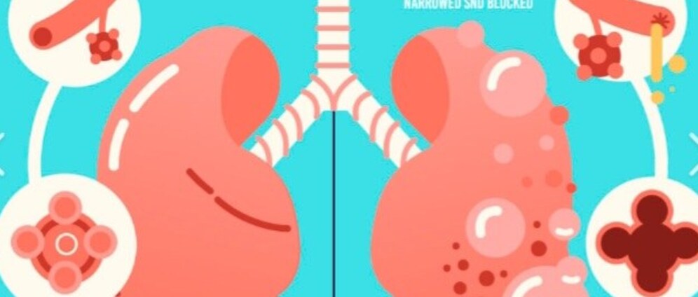 Geld inzamelen | Help mij en mijn fam zodat ik de aankomende jaren verbeterde kwaliteit van leven heb. | Doneeractie