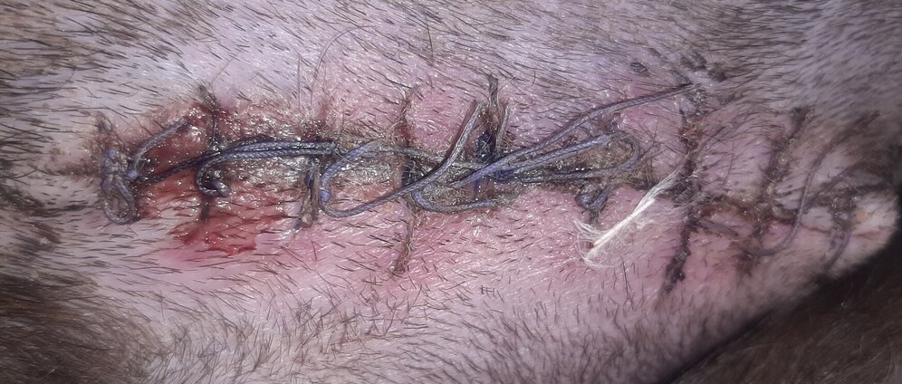 Geld inzamelen | Zena operatie tumor | Doneeractie