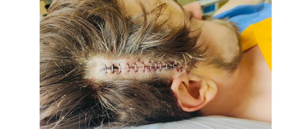 Geld inzamelen | Schedelbasisfractuur | Doneeractie